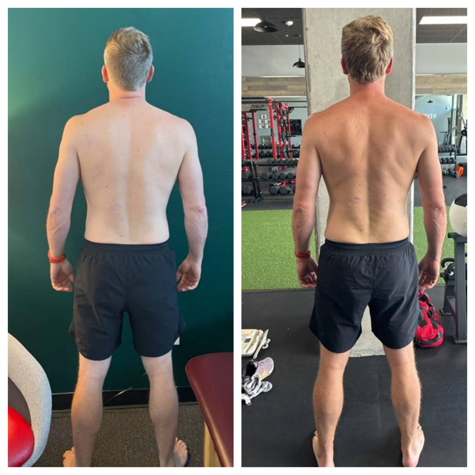 Core Progression Results Before and After Image