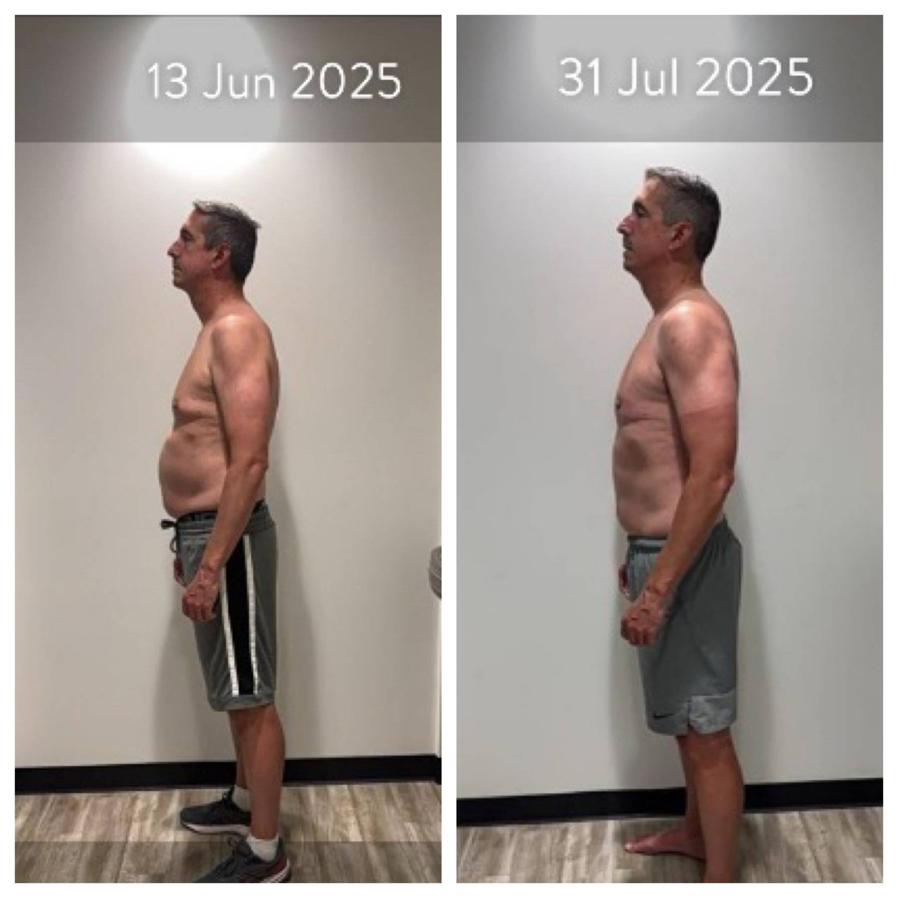 Before & After results