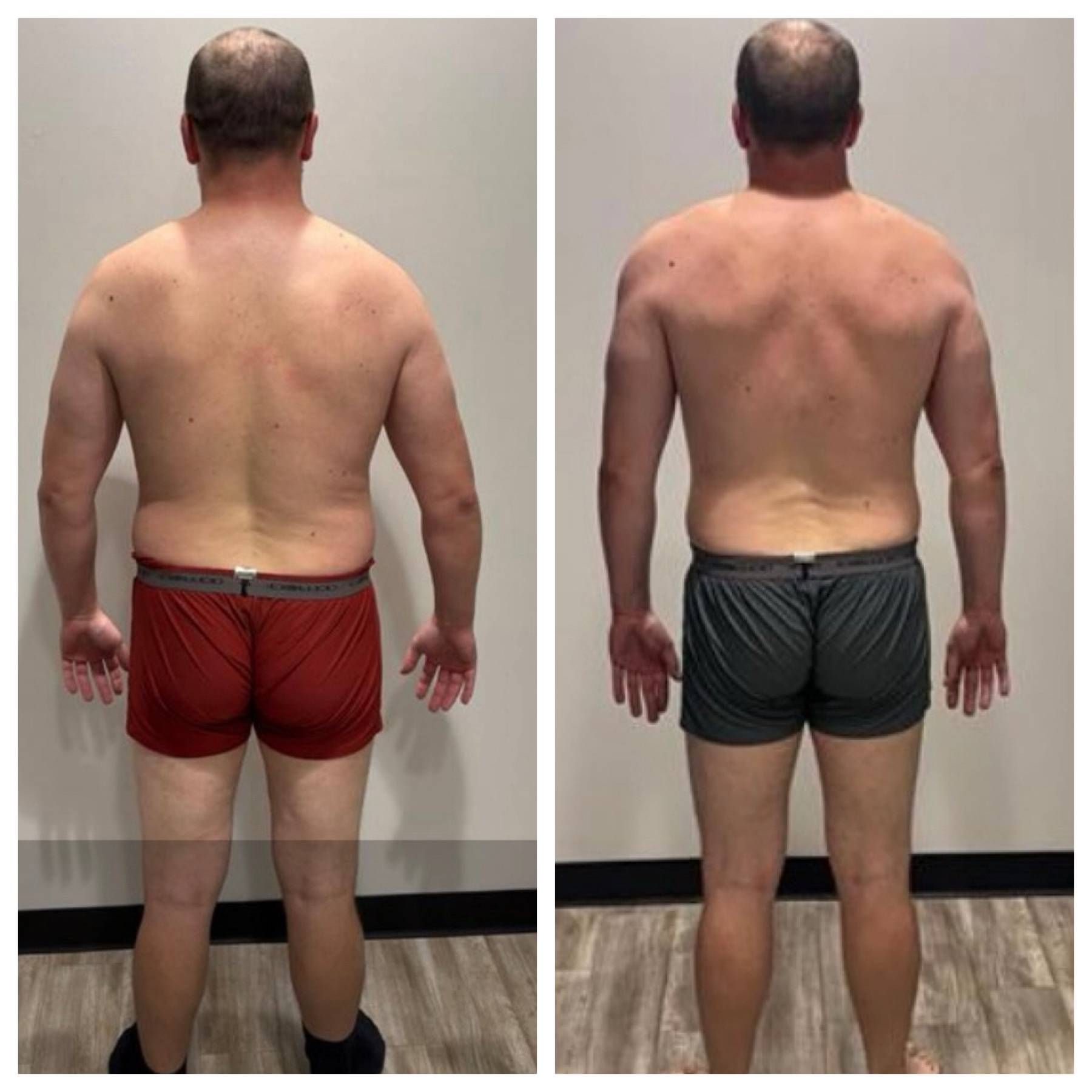 Before & After results