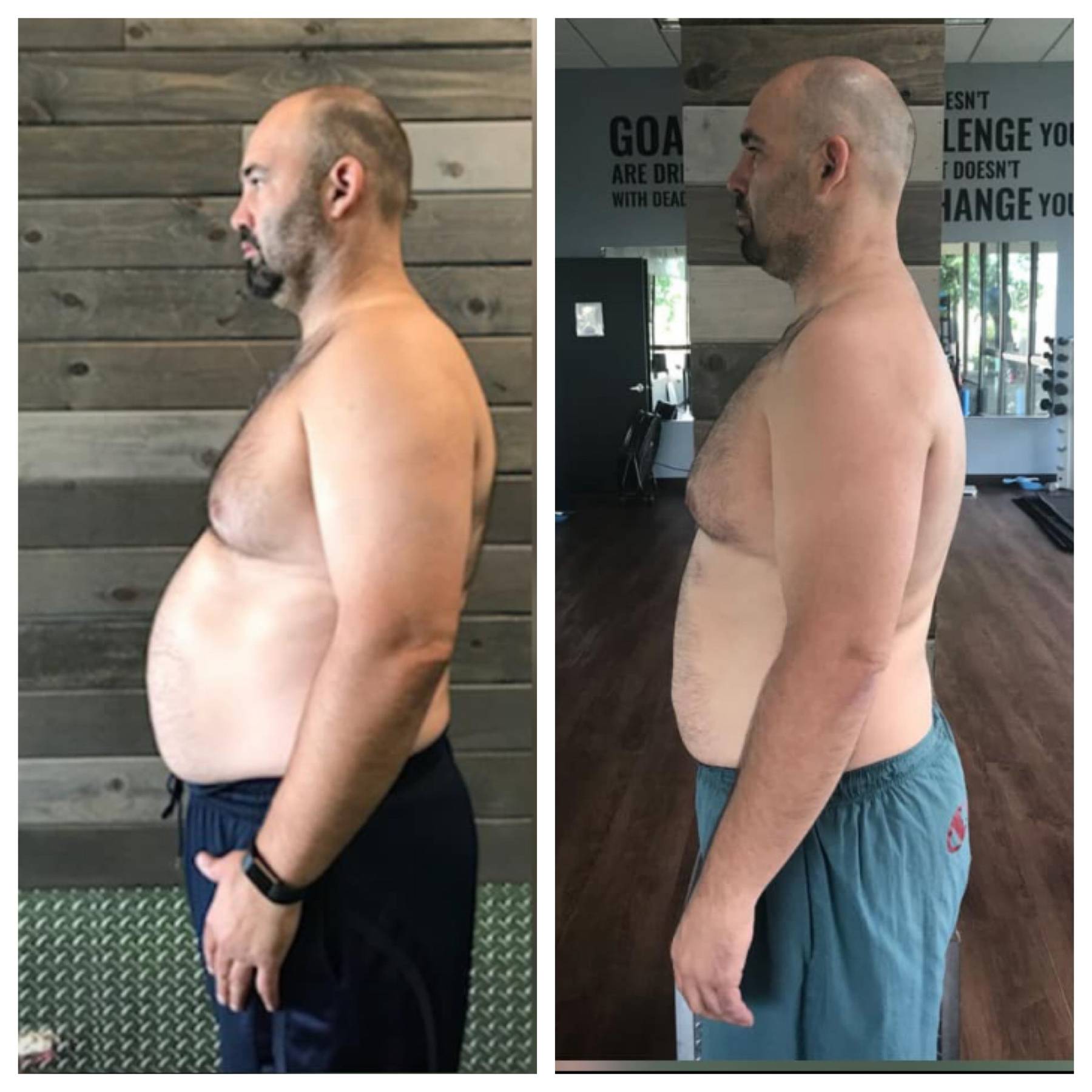 Core Progression Results Before and After Image